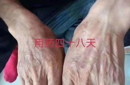 案例展示